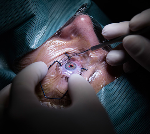 Cirugía láser de ojos en Bogotá, hombre sometido a operación